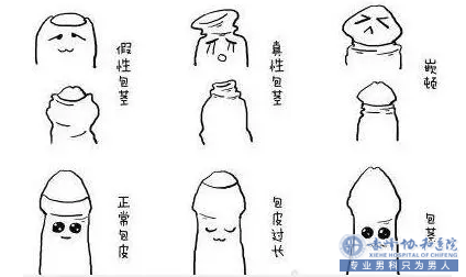 赤峰男科医院 真假包茎区别大,你会分辨吗?