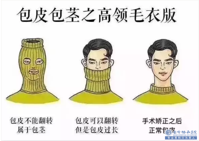 赤峰男科:“非割不可”的包皮